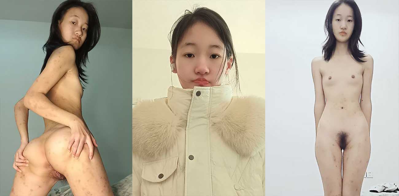 山东临沂电子科技学院风骚学妹【张雯娟】约炮成瘾脚踏多船身染性病全身溃烂还自慰扣穴